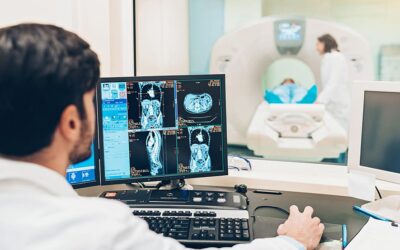 What are the Differences Between MRI and CT Scans?