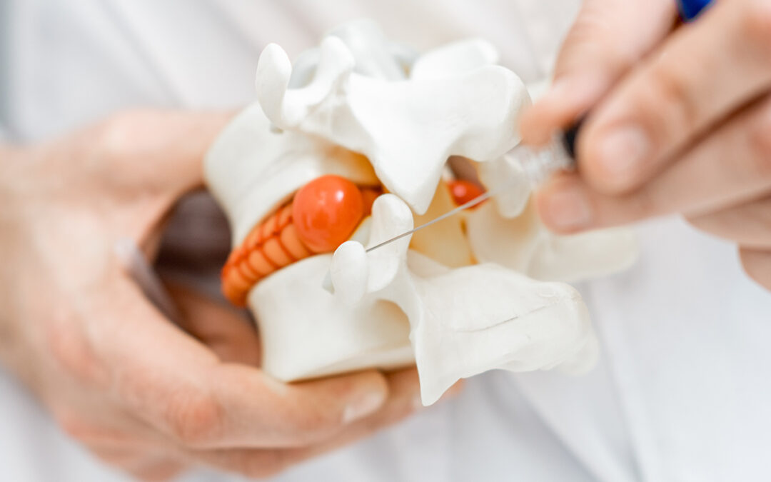 Disc Herniation: A Patient’s Guide to Spine Structure and Symptoms