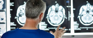 Protecting Your Brain: Concussion Diagnosis and Treatment